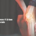 Your Guide to Expenses: FT 3D Knee Resurfacing Cost in India