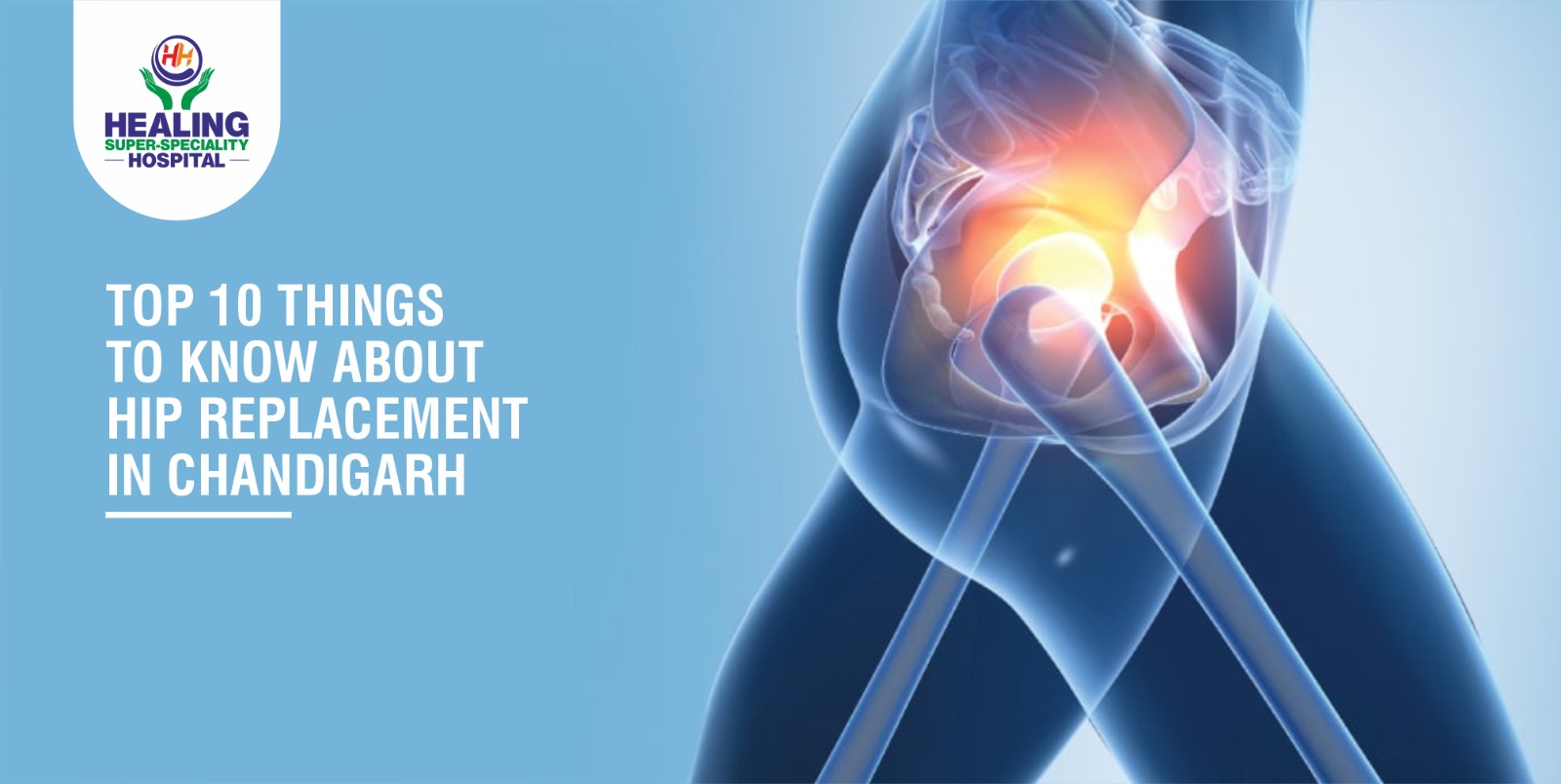 Top 10 Things to Know About Hip Replacement in Chandigarh