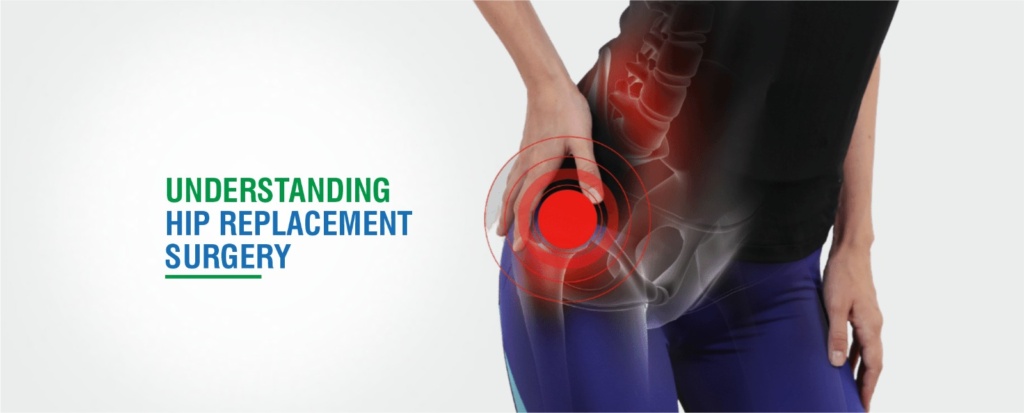 hip replacement surgery in Chandigarh