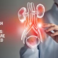 Chandigarh Urologist Specialists: Quality Care Guaranteed
