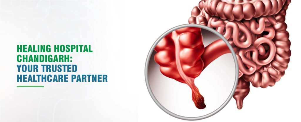 Appendicitis Surgery in Chandigarh