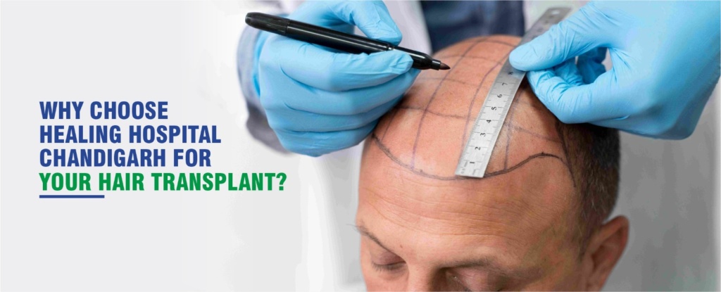 Best hair transplant in chandigarh