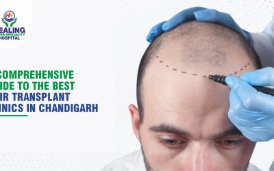Best hair transplant in chandigarh