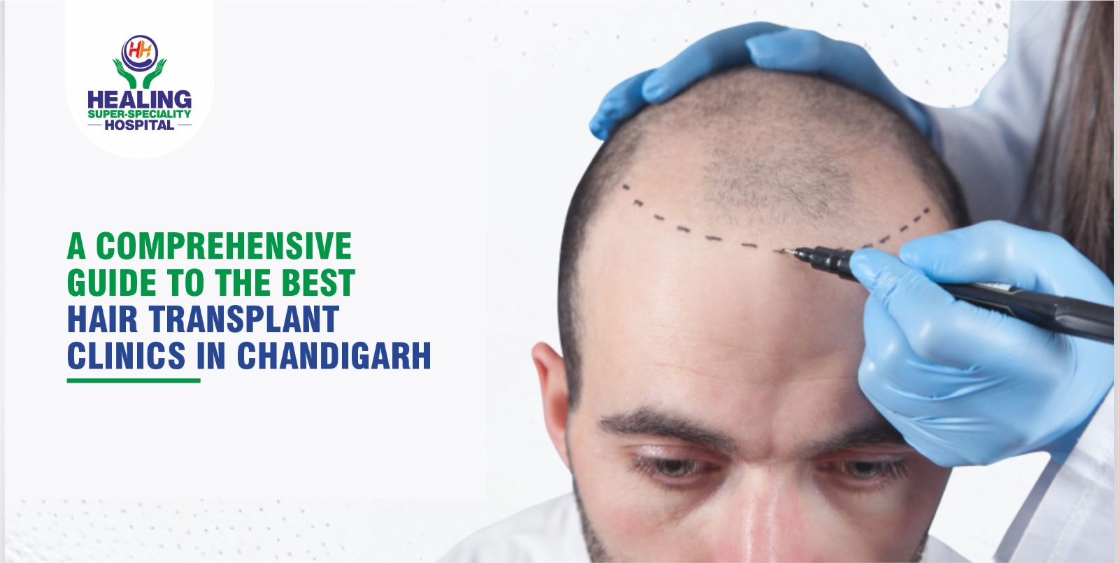 Best hair transplant in chandigarh