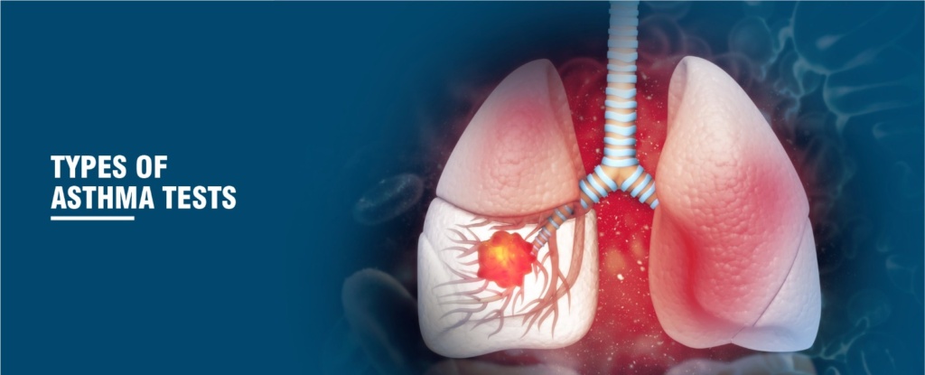 asthma test cost in india