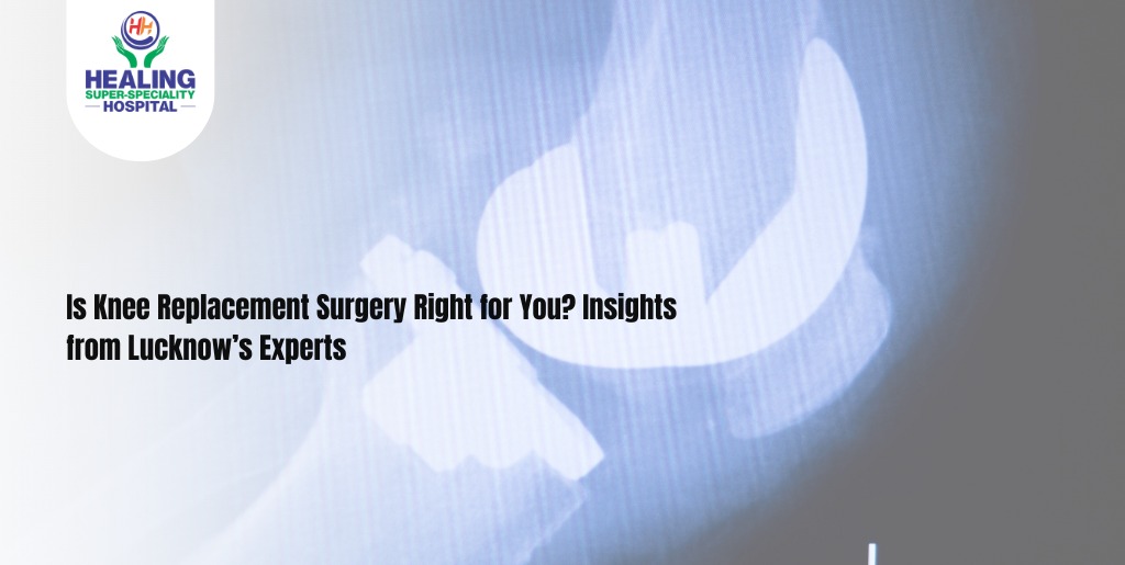 Is Knee Replacement Surgery Right for You? Insights from Lucknow’s Experts