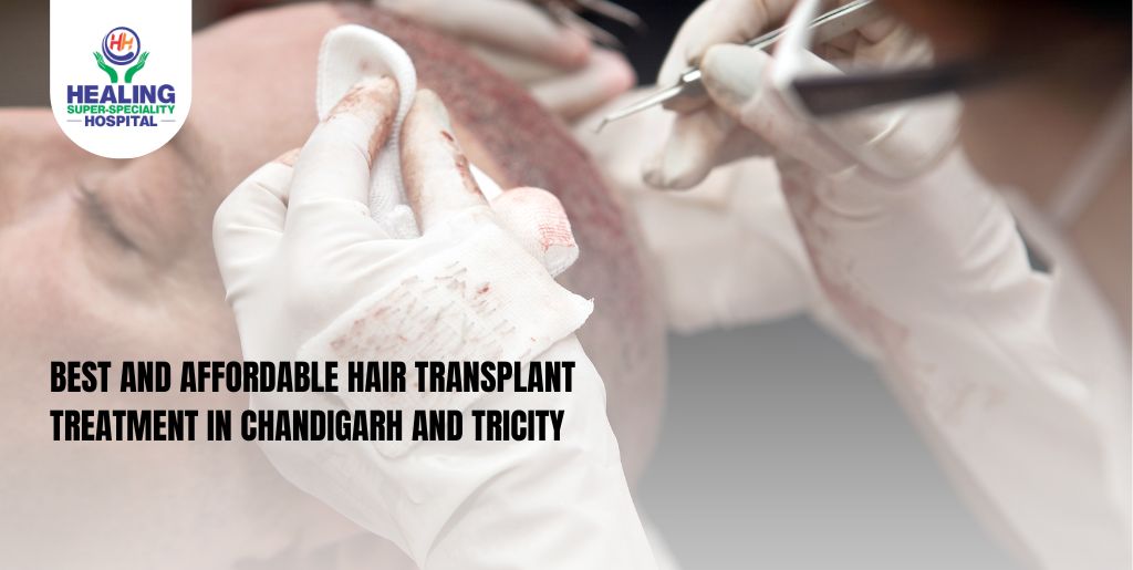 Hair Transplant Treatment in Chandigarh