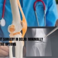 Knee Replacement Surgery in Delhi: Minimally Invasive & Effective Options