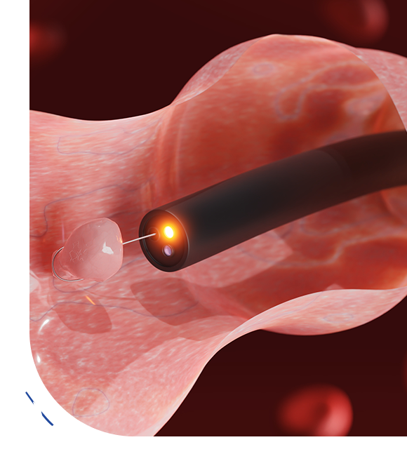 Why Choose Healing Hospital in Chandigarh for Colonoscopy