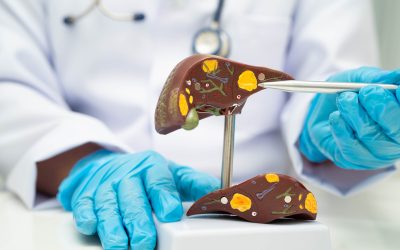Silent Fatty Liver Symptoms