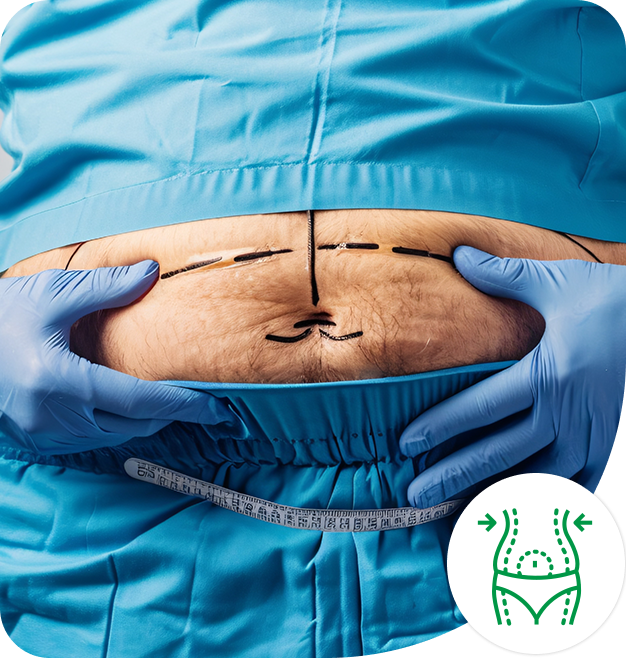 Advanced-HD-Liposuction