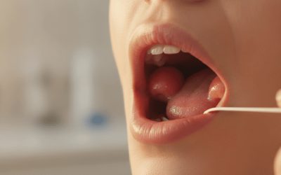 How to Recognize Tonsillitis Symptoms and Get the Right Treatment